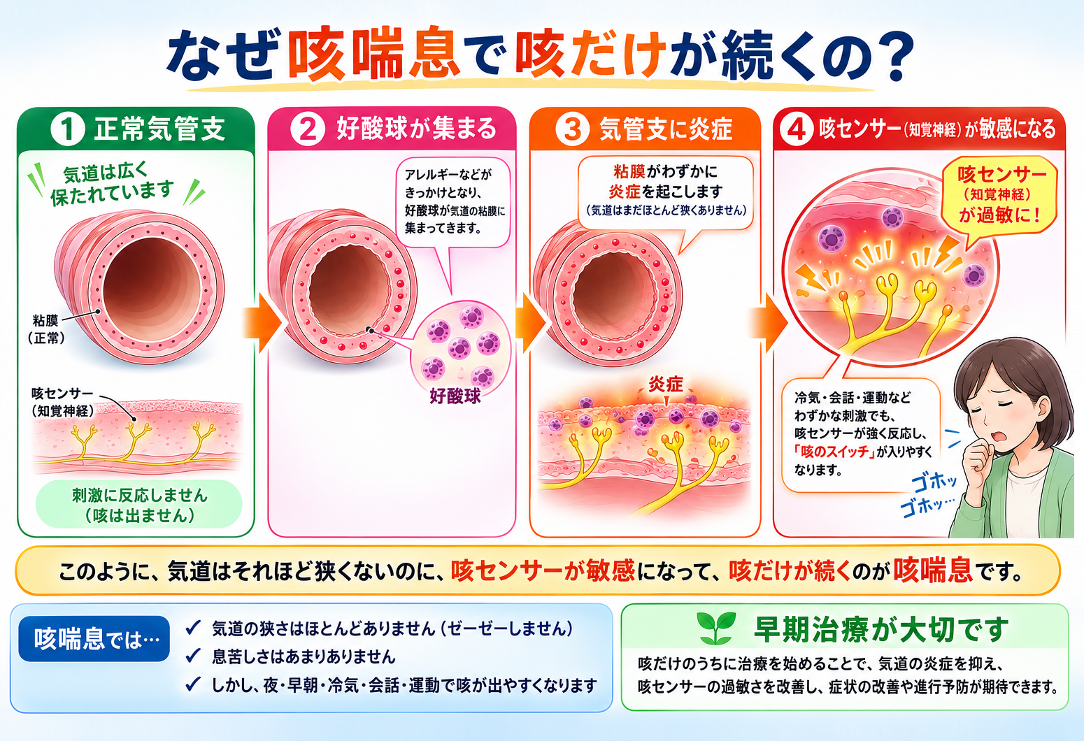 なぜ咳喘息で咳だけが続くの？ 気管支の炎症で咳センサー（知覚神経）が敏感になり、咳だけが続くしくみの図解