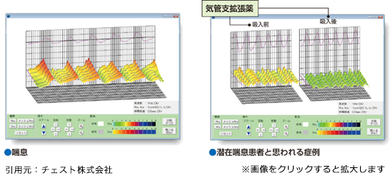 気管支拡張薬を吸ってもらった前と後の呼吸の状態